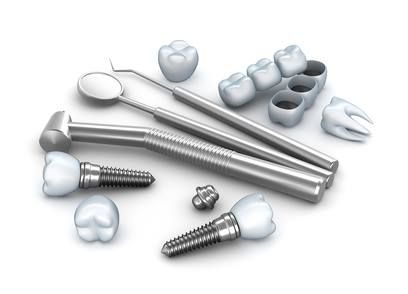 Implanty zębów - czym tak naprawdę są i ile kosztują?