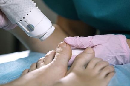 Grzybica paznokci – przyczyny, objawy oraz leczenie