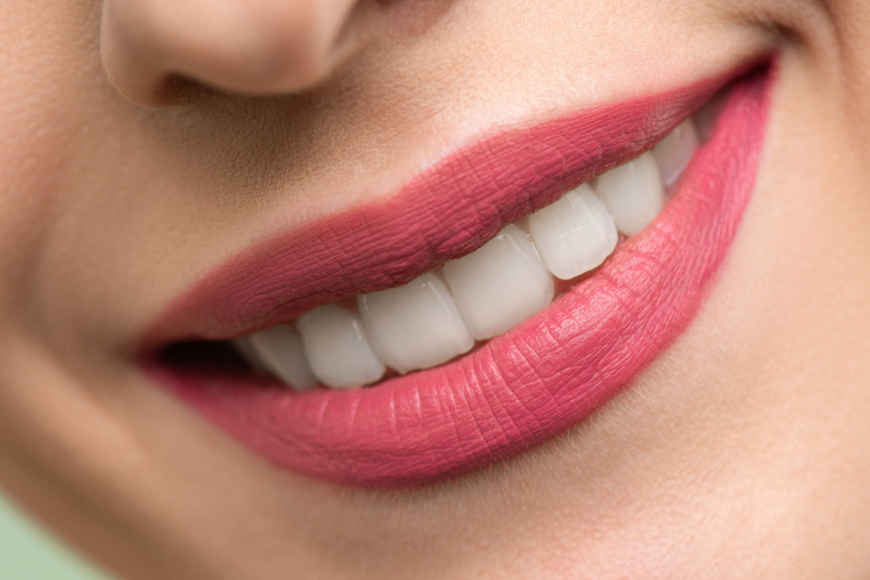 Czy wybielanie zębów jest szkodliwe?