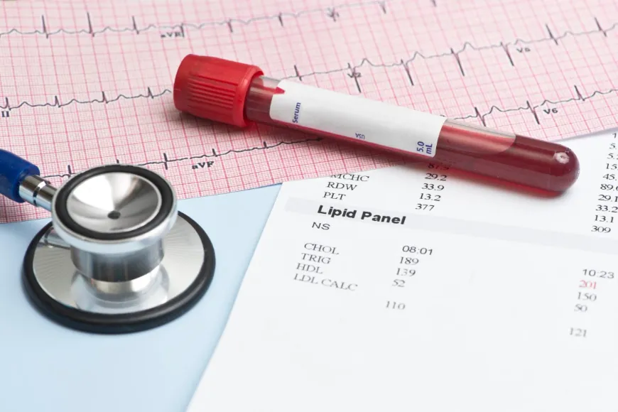 Cholesterol powyżej 300: czy to dużo? Wyjaśniamy