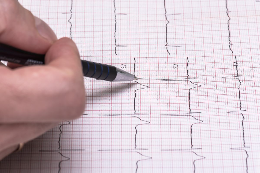 Badanie holtera - podstawowa diagnostyka serca