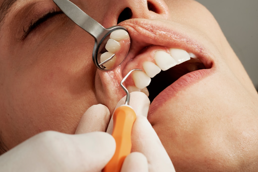 Sanacja jamy ustnej a operacje